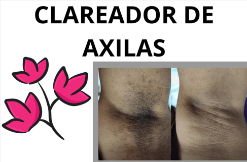 Resultado Comprovado do Esfoliante Amazolé
