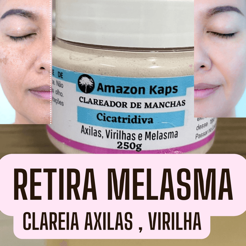 Benefício de clarear melasma